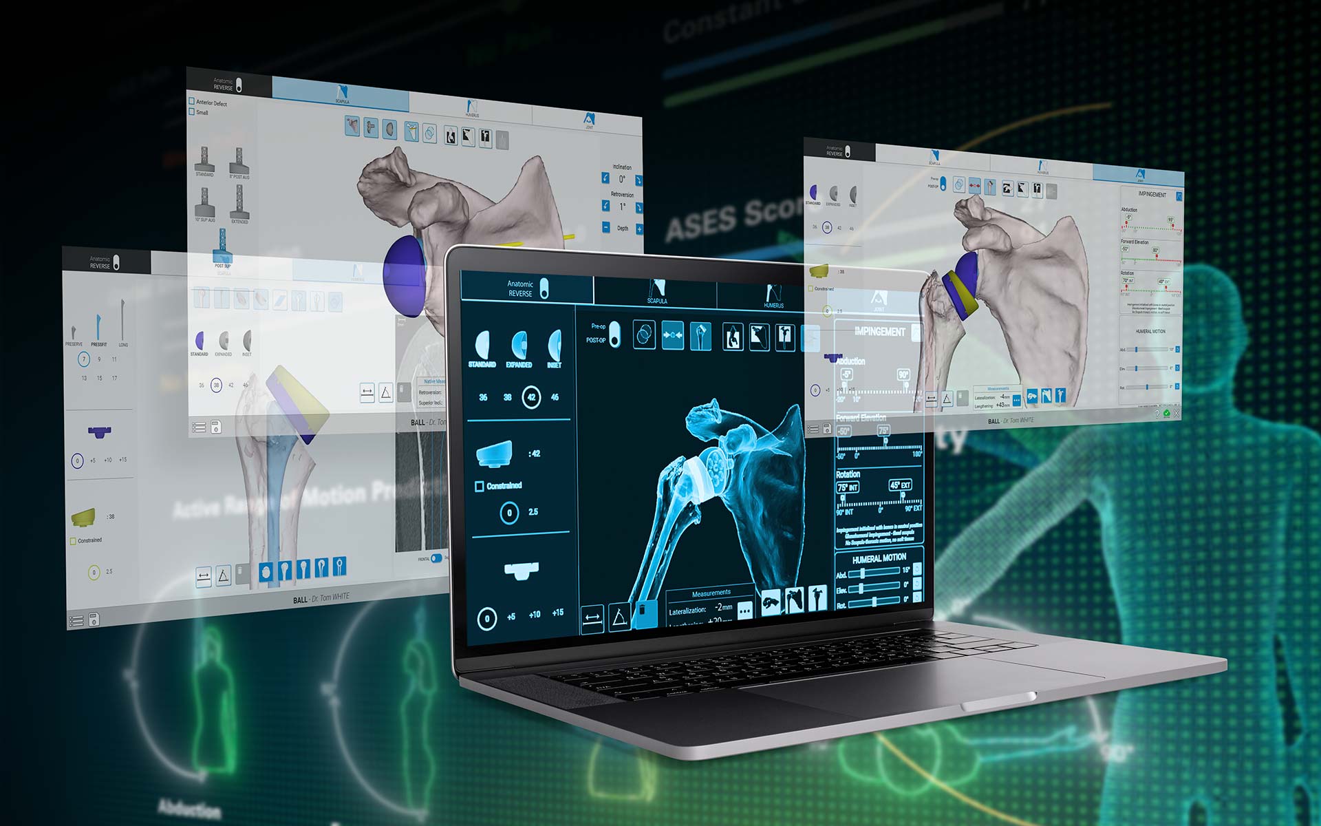 Shoulder Planning App