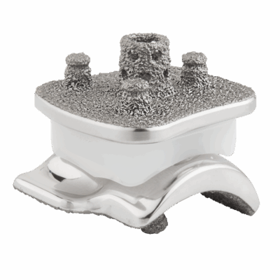 Vantage Sprunggelenk