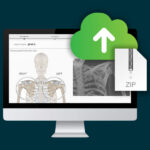 Active Intelligence Shoulder Planning CT Scan Uploader on AI One